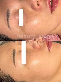 ヴィーナス(Venus)/白玉スキンフェイシャル