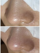 フラリス(fraris)/