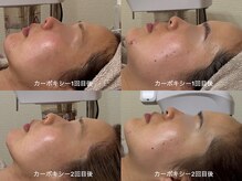 ハニエル(Haniel)の雰囲気（肌の土台から整え、荒れにくく揺らぎにくい肌へ♪）
