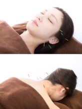 瑞江TBM鍼灸整骨院