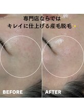 ベレア(BELEA)/専門店だからこそ際までできる☆