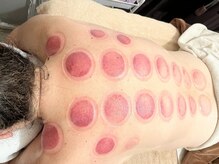 サロン バイオビオ(SALON BioBio)の雰囲気（疲れがとれない、肩こりや腰痛、背中の痛みにお悩みの方へ）