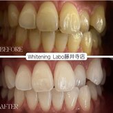 ホワイトニングラボ(Whitening Labo)