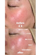 ラシサ(LASHISA)/フェイスワックス(全顔)