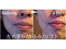 太陽と月/小顔調整♪歪み/たるみ抜群！