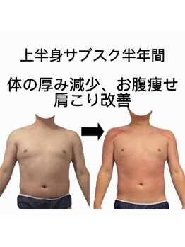 スピード美人 新宿店/スライドカッピング上サブスク