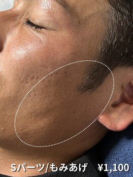 カナウ(KANAU)/【Sパーツ/脱毛】もみあげ