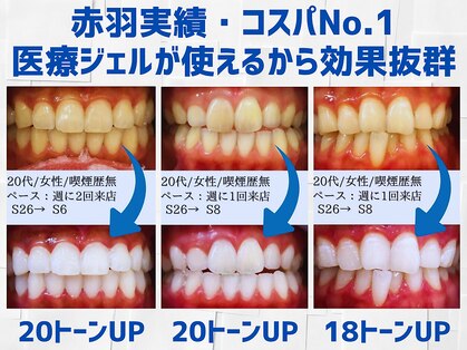 スマイルホワイト 赤羽店の写真