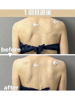 メゾン ド クロエ(Maison de Chloe)の写真/『着たいドレスを“似合うドレス”に』ドレスを着た時、背中のラインや姿勢で印象は驚くほど変わります