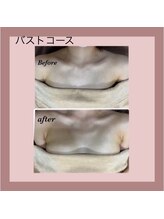 エステティック レイビス 秋田店(RAYVIS)/予約殺到！ふわふわ３Dバスト