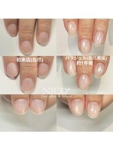 ニコプラス(NICO+)/自爪育成中