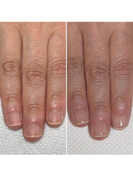 リヒネイル(Rihi.nail)/自爪育成