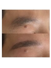 フォルマ(FORMA)/ハリウッドブロウリフト