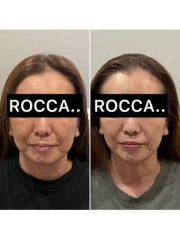 ロッカ(ROCCA..)/テラボーラー♪