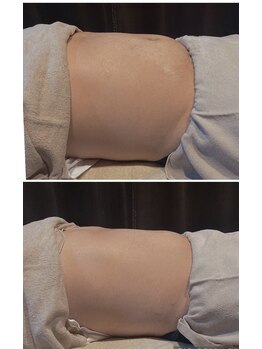 ヴァローレ(valore)/腸もみ