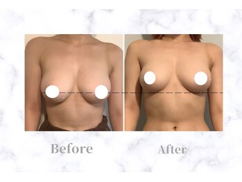 ふじこのきもち/12回コース終了　20代