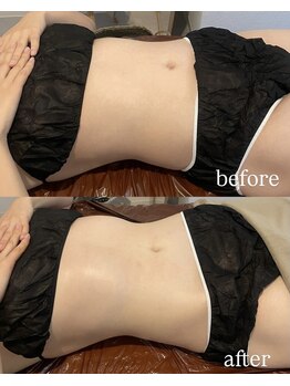 ウェルフォーセルフ(WELL FOR SELF)/キャビテーション×筋膜リリース