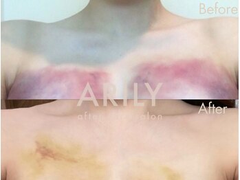 アリリィ(ARILY)/ARILY after care salon