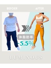 ルミナス(Luminous)/ビフォーアフター２