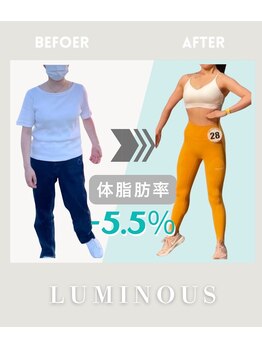 ルミナス(Luminous)/ビフォーアフター2