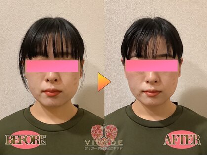 小顔・姿勢・骨盤矯正・美脚・ダイエット ヴィオーデ美容整体サロン 川越店の写真