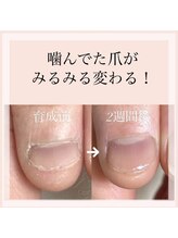 イオネイル(io nail)/自爪育成コース