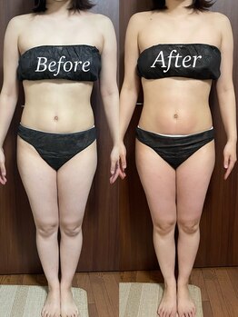 ヴィム(VIM)/ハイパーナイフビフォーアフター