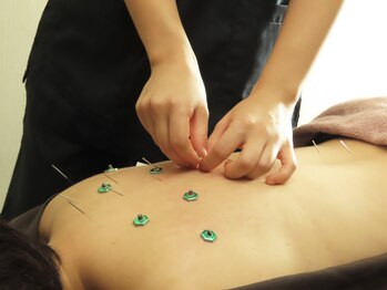 ポルクス鍼灸整骨院 表参道(Pollux鍼灸整骨院)/鍼灸 整体 美容鍼灸