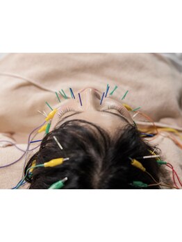 鍼灸施術を受けたい