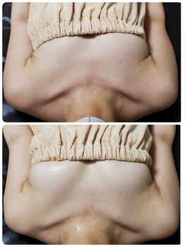 ビープラス(B+)/上:before 下:after