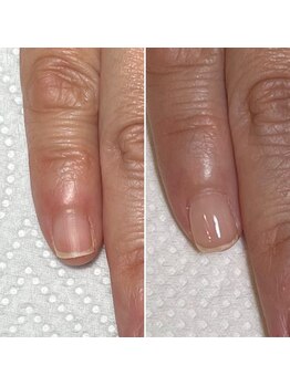 リヒネイル(Rihi.nail)/自爪育成