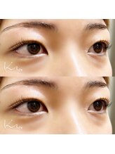 クレー(Klee)/パリジェンヌラッシュリフト