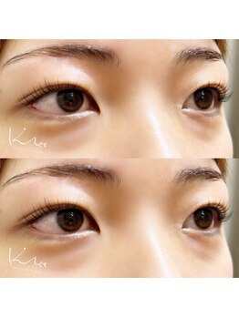 クレー(Klee)/パリジェンヌラッシュリフト