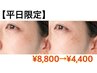 【平日限定】シミケア10分当て放題半額フェア！！