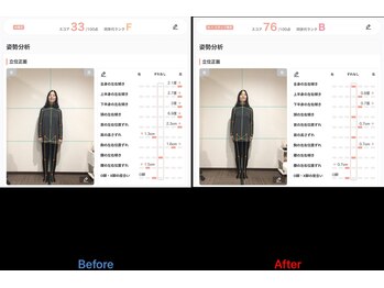 鹿児島整体院/姿勢33→76 猫背・肩こり改善