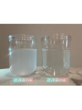 マボーテハル/毛穴の皮脂ごっそり吸引＆洗浄