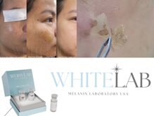 ローマピンクから最新シミケア誕生◎エリア初！近日導入！