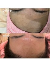 サロン クベル(Salon Kvell)/フェイスワックス