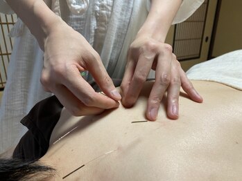 サンズイ(SANZUI)の写真/お顔もお体も同時に不調を解消できる。全身鍼灸×美容鍼で内側から溢れる美しさを手に入れられる