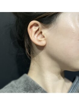 ラリマ グラマラス(Larima Glamorous)の写真/【韓国で人気のレモンボトル導入】削らない・押さない！ダウンタイムなし☆洗練された美しい輪郭へ。