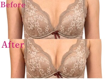 アファン 鶴見店(Afun)/バストアップBeforeAfter
