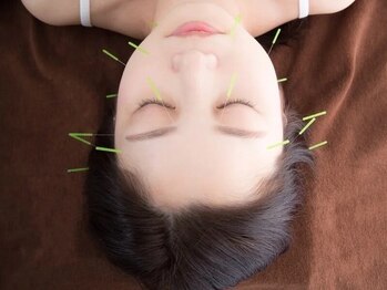 しんのう鍼灸院の写真/【この感動をあなたに!】立体造顔美容鍼+体の中から整う全身鍼灸で、身体の不調を全身から整えませんか?