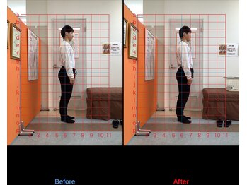 ゼロヒャク整骨院(ZERO100整骨院)/骨盤矯正×ストレッチ