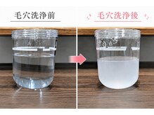 トゥルン(Tworun)の雰囲気（毛穴洗浄で皮脂詰まり解消！美容鍼セットで効果実感アップ促進へ）