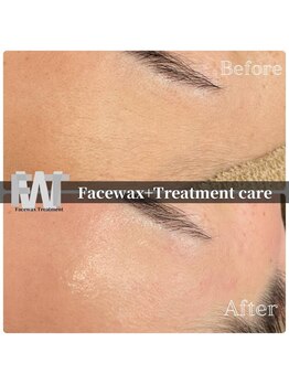 サロン ド レア(Salon de Lea)/WAX脱毛なのに美肌も手に入れる