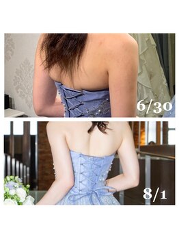 ライズ/お客様のビフォーアフター