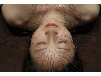 オリエントセラピー(ORIENT THERAPY)/鬼神美容鍼(ルート鍼ベース)