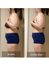 ココカラ(COCOKARA)/インディバ/アロマ　痩せ