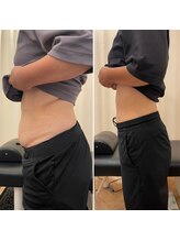 ナオ接骨院(NAO接骨院)/Before／After