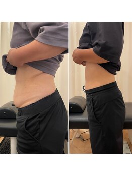 ナオ接骨院(NAO接骨院)/Before/After